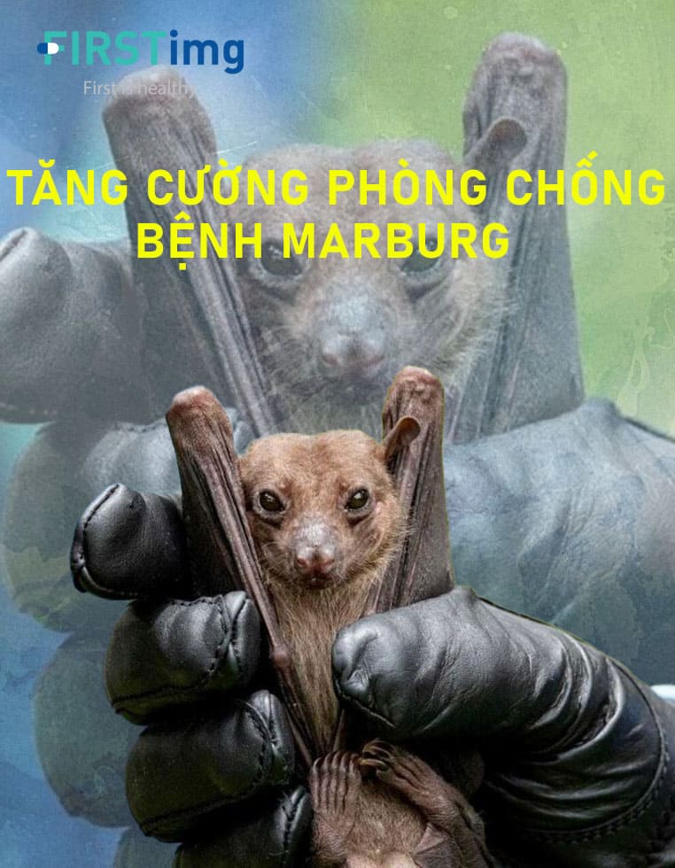 phòng chống bệnh marburg