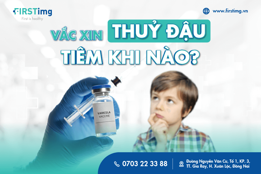 vắc xin Thủy đậu tiêm khi nào